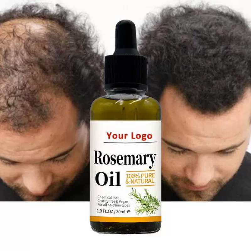 Organic Jojoba Serum Building Fibers Powder Tonics Scalp Regrowth Treatment Hair Oil Hair Growth Batana Oils Essential Oil 