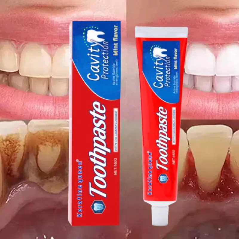 OEM Wholesale Toothpaste Teeth Whitening Anti Cavity Oral Care Mint Flavor Fresh Breath Whiten Teeth Deep Cleaning Protect Gums
